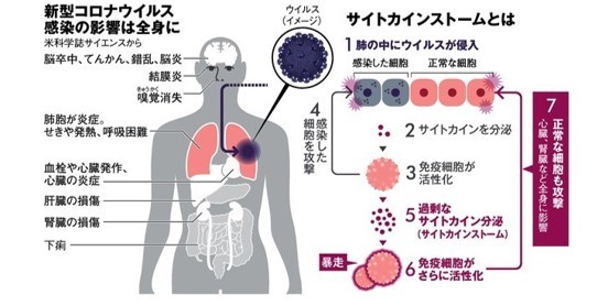 サイトカインストームの仕組み