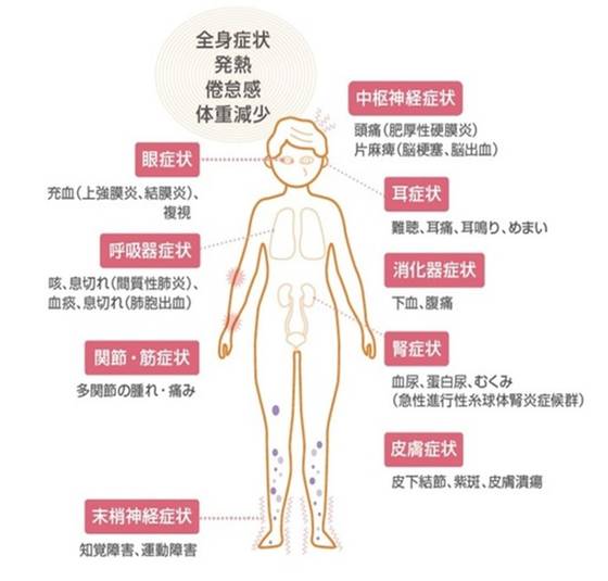 コロナウィルスによる全身に見られる症状